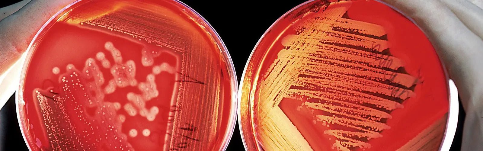 Conservadores naturales para cosmética